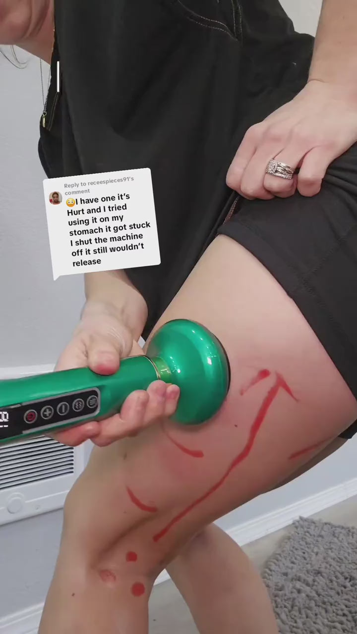 Creator demonstrating the Revimus Anti-Cellulite Massager on cellulite-prone skin