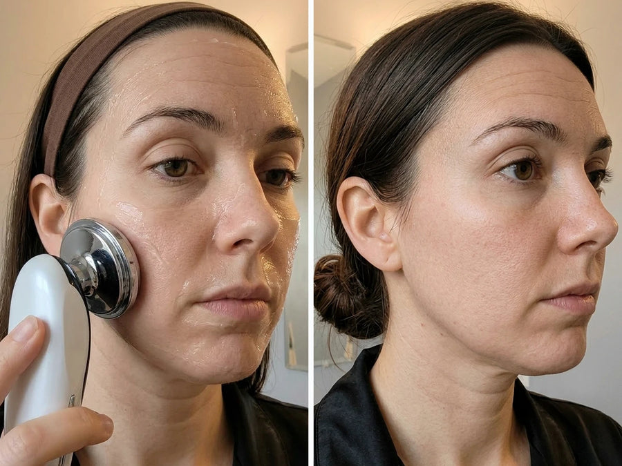 Immediately after 1 session with the Revimus LUMA Sculpting Wand