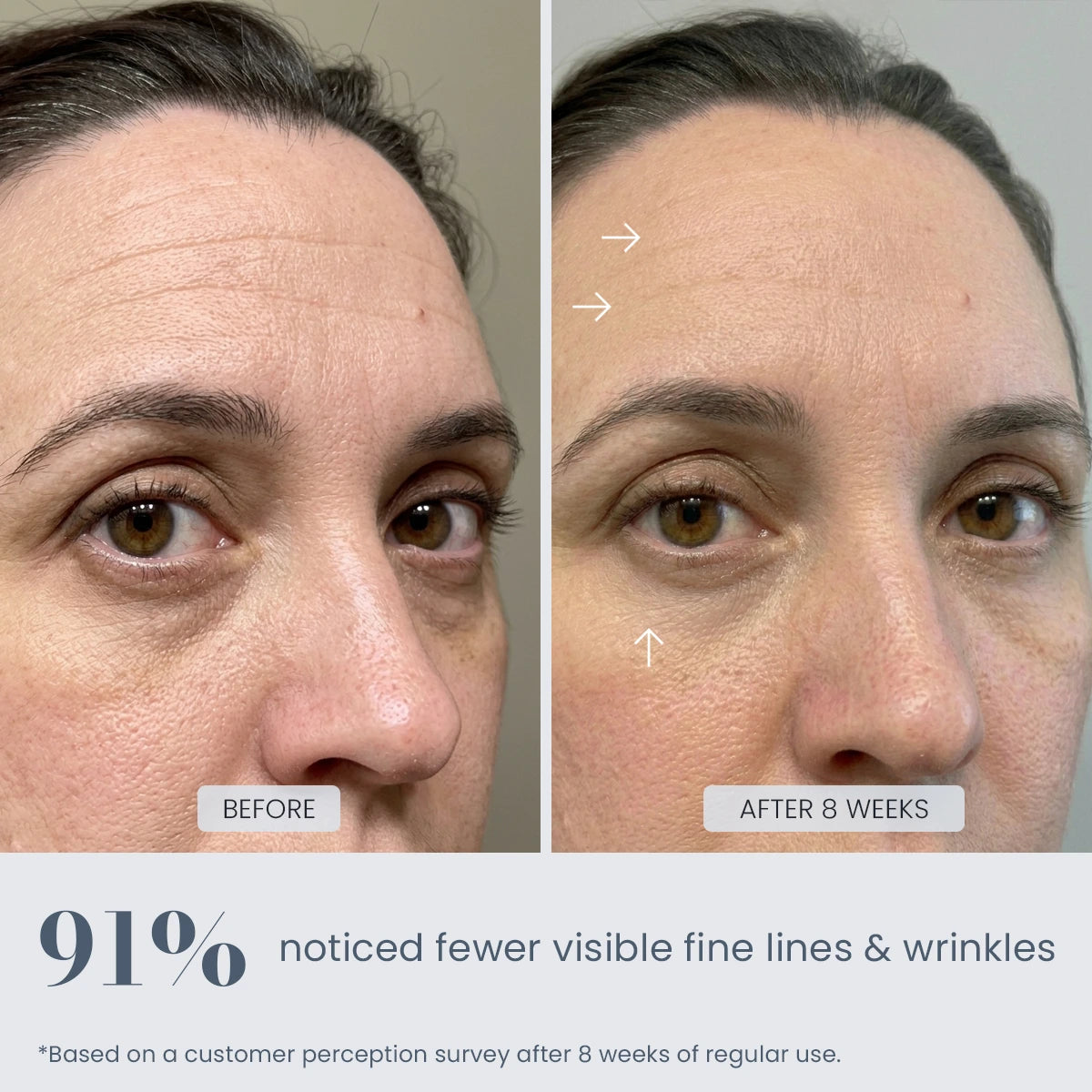 Before and after 8-week results showing reduced appearance of fine lines and wrinkles with REVIMUS ORBIT