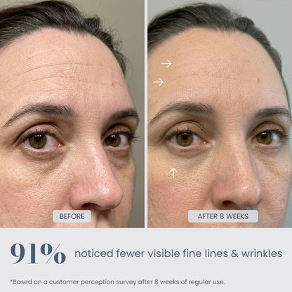 Before and after 8-week results showing reduced appearance of fine lines and wrinkles with REVIMUS ORBIT
